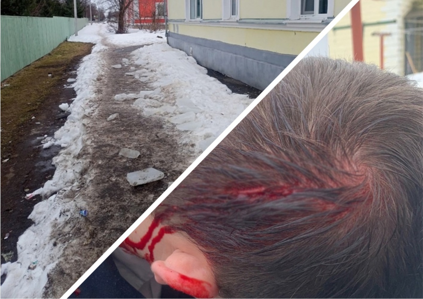 В Рыбинске курсанту рассекло голову упавшей глыбой льда