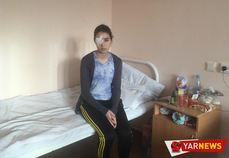 Девушке, пострадавшей в квест-комнате в Рыбинске, удалят глаз