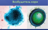 В Ярославской области регистрировалось три групповых очага кори