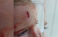 В ярославском ТЦ «Аура» маленькая девочка рассекла себе лоб