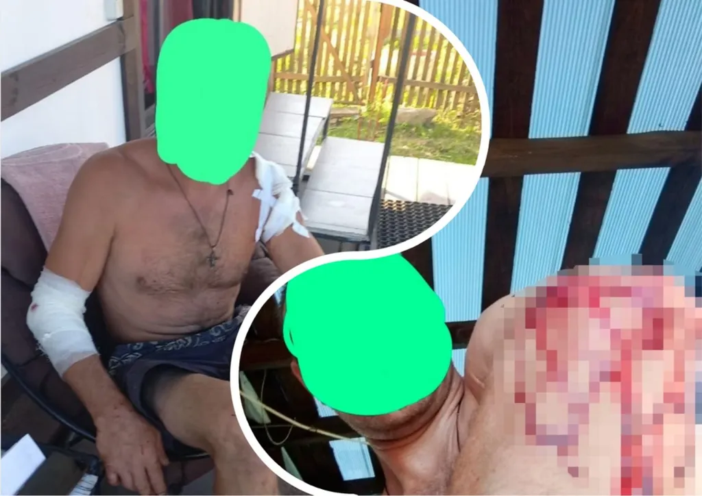 Под Ярославлем алабай на самовыгуле покусал мужчину