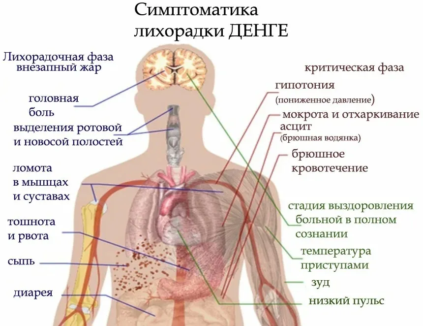 Роспотребнадзор предупредил ярославские больницы о египетской лихорадке