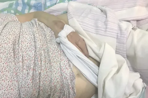 «Страшно и больно»: пациенты рассказали о выживании в ярославской больнице
