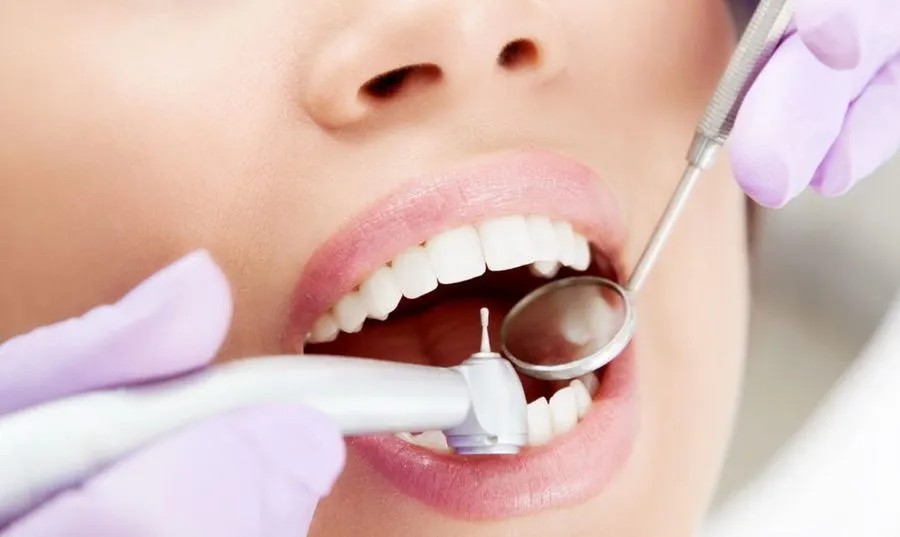 Лечение зубов в «DentaGuard»