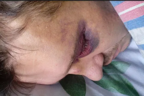 Избили до полусмерти и залили водкой: как ярославцы скрывали преступление