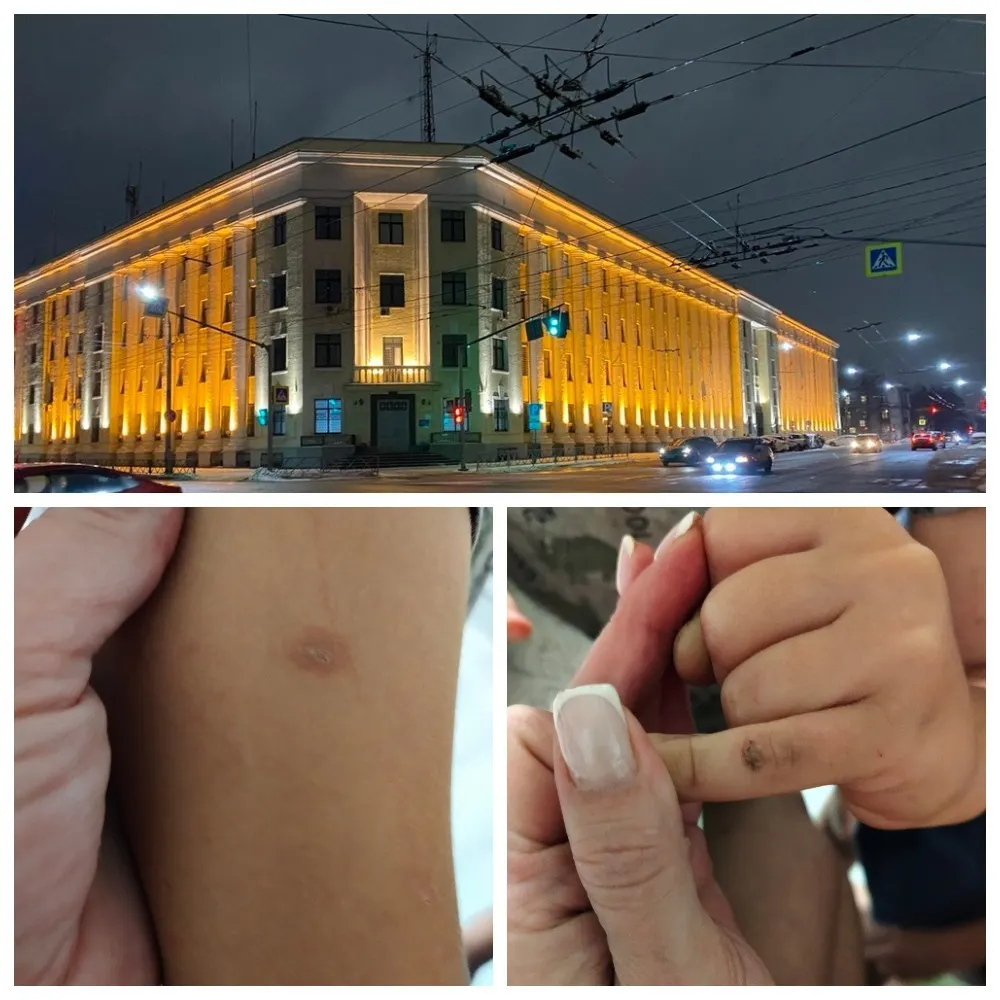 Полиция проверит случаи нападения на детей в Ярославле