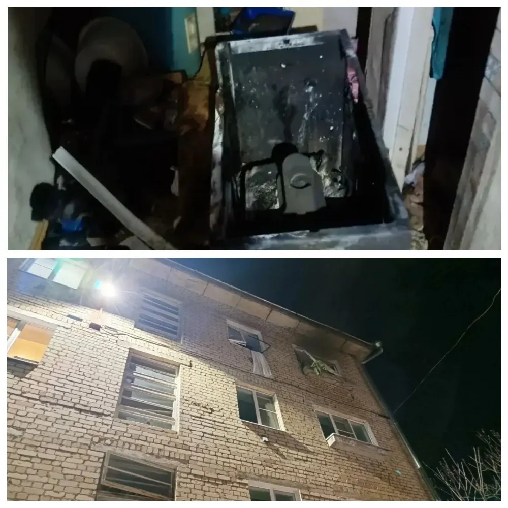 Ярославна пострадала в пожаре, начавшемся из-за стиральной машинки