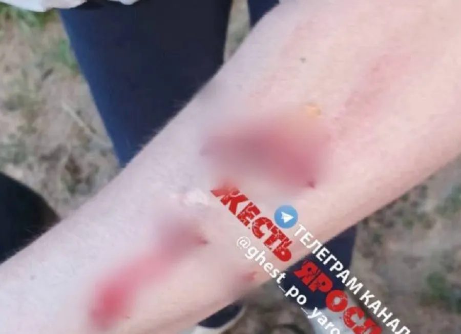 В Ярославле ищут хозяина покусавшей женщину собаки