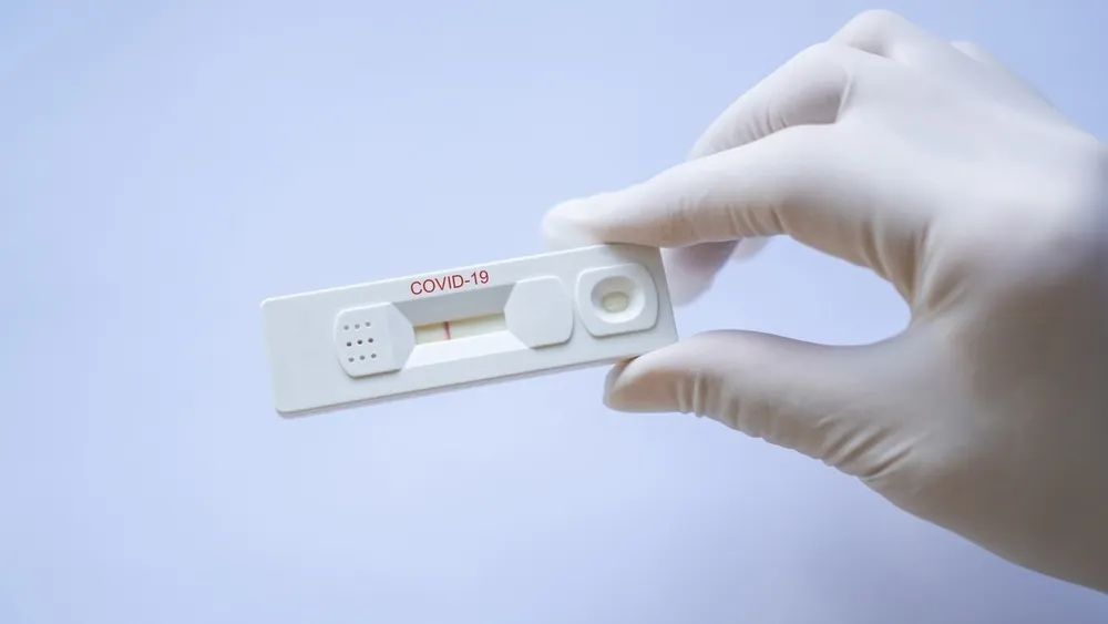 Ярославская область закупит 60 тысяч экспресс-тестов на COVID-19