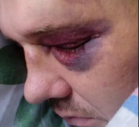 Избили до полусмерти и залили водкой: как ярославцы скрывали преступление