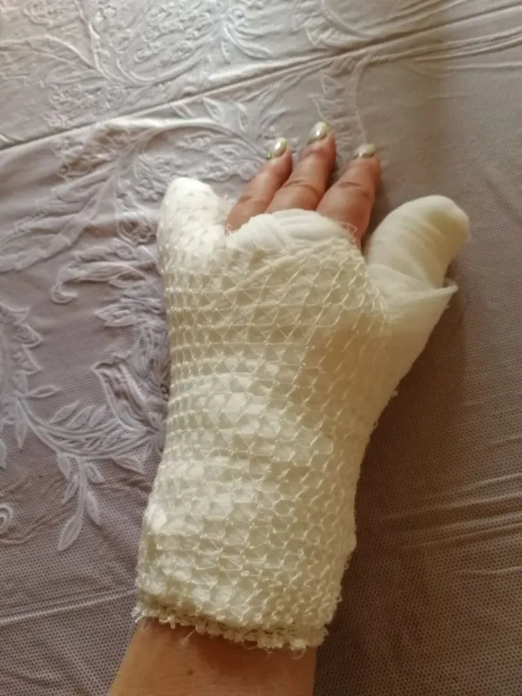 В Ярославле на сотрудницу «Управдома» напали кошки