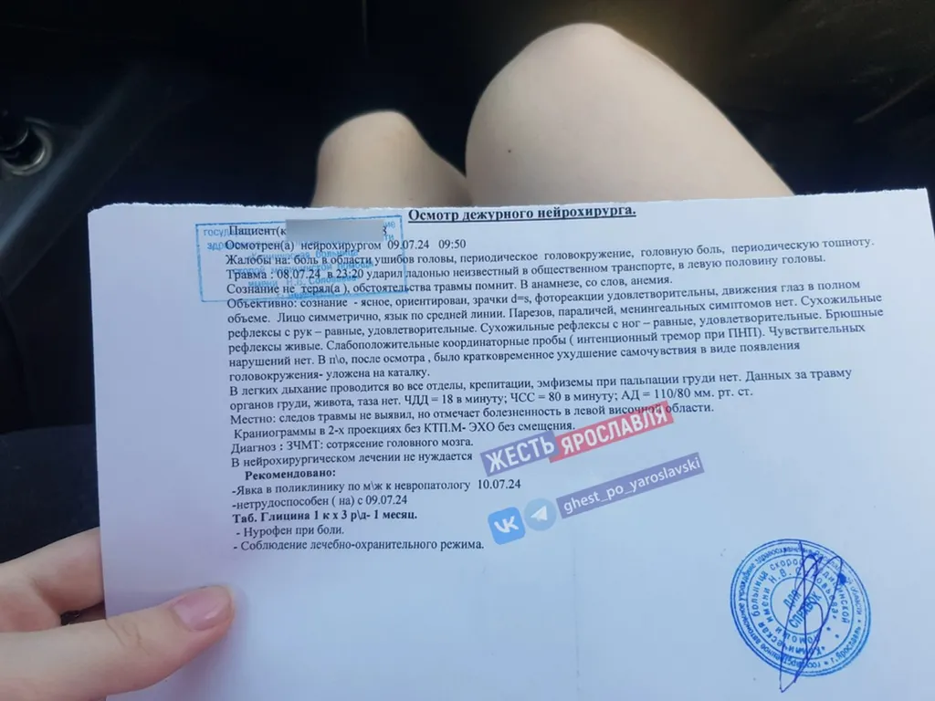 В Ярославле пассажирка получила сотрясение мозга после конфликта в автобусе